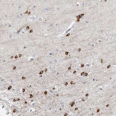 Immunohistochemistry-Paraffin: HIPK4 Antibody [NBP1-81987]