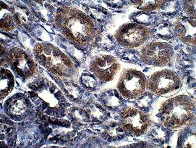 Immunohistochemistry-Paraffin: HIPK4 Antibody [NBP3-12399]