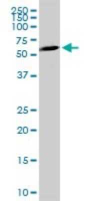 Western Blot: HIPK4 Antibody [H00147746-D01P]