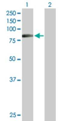 Western Blot: HIPK4 Antibody [H00147746-D01P]