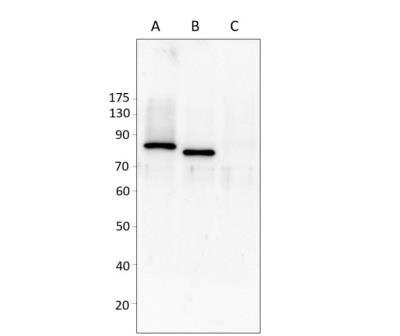 Western Blot: HIPK4 Antibody [NBP3-12399]
