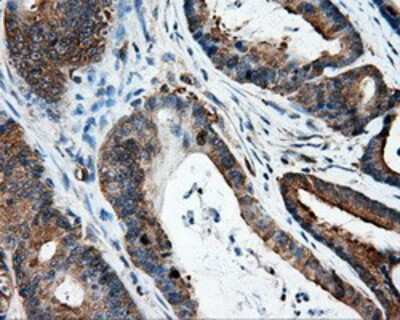 Immunohistochemistry-Paraffin: HIPPI Antibody (OTI4F6) [NBP2-02313]