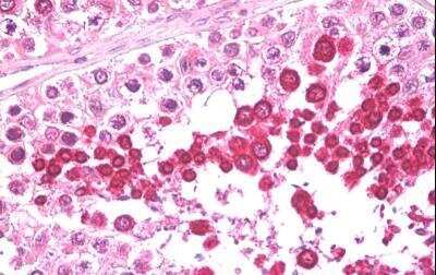 Immunohistochemistry-Paraffin: HIPPI Antibody [NBP1-28913]