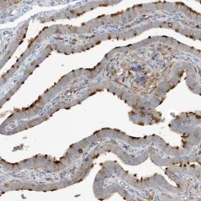 Immunohistochemistry-Paraffin: HIPPI Antibody [NBP1-84787]