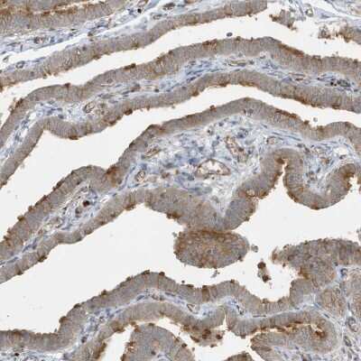 Immunohistochemistry-Paraffin: HIPPI Antibody [NBP1-84788]