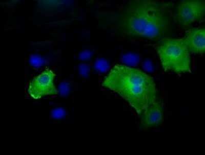 Immunocytochemistry/ Immunofluorescence: HIPPI Antibody (OTI4F6) - Azide and BSA Free [NBP2-71985]