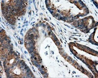 Immunohistochemistry: HIPPI Antibody (OTI4F6) - Azide and BSA Free [NBP2-71985]