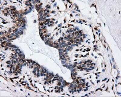 Immunohistochemistry: HIPPI Antibody (OTI4F6) - Azide and BSA Free [NBP2-71985]