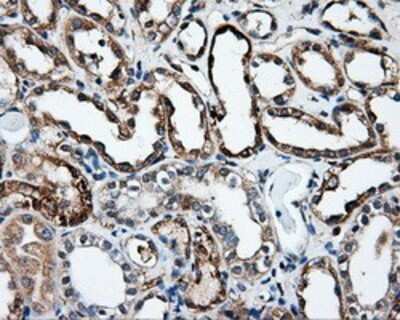 Immunohistochemistry: HIPPI Antibody (OTI4F6) - Azide and BSA Free [NBP2-71985]