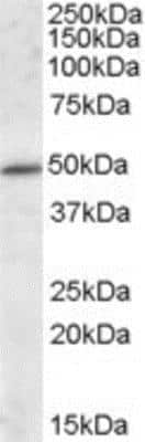 Western Blot: HIPPI Antibody [NBP1-28913]