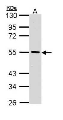 Western Blot: HIPPI Antibody [NBP1-32932]