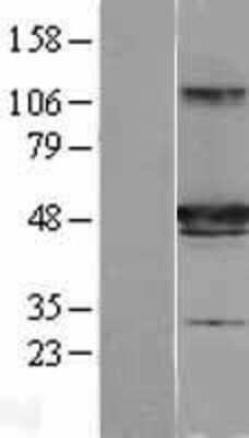 Western Blot: HIPPI Overexpression Lysate [NBL1-11860]