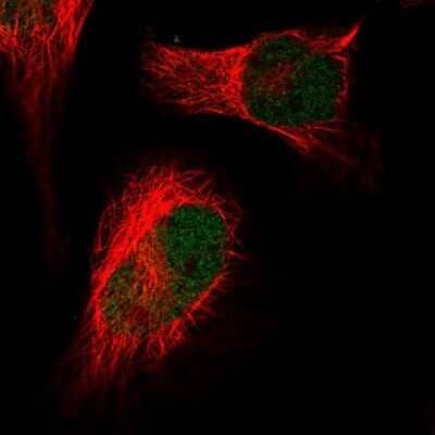 Immunocytochemistry/ Immunofluorescence: HIRA Antibody [NBP2-55647]