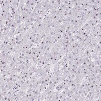 Immunohistochemistry-Paraffin: HIRA Antibody [NBP2-38636]