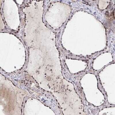 Immunohistochemistry-Paraffin: HIRA Antibody [NBP2-38636]