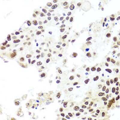 Immunohistochemistry-Paraffin: HIRA Antibody - BSA Free [NBP3-04894]