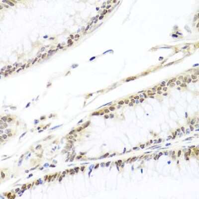 Immunohistochemistry-Paraffin: HIRA Antibody - BSA Free [NBP3-04894]