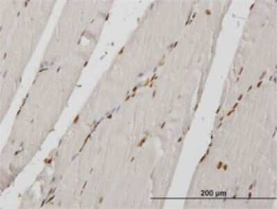 Immunohistochemistry-Paraffin: HIRIP3 Antibody (3B3) [H00008479-M01]