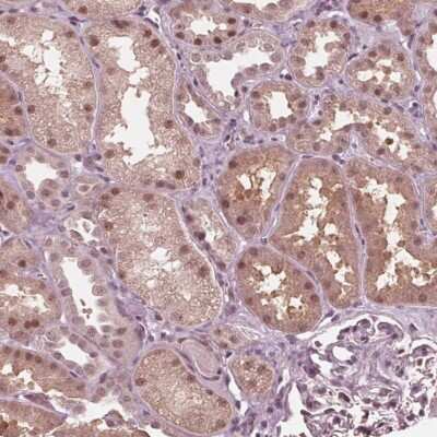 Immunohistochemistry: HIRIP3 Antibody [NBP2-38020]