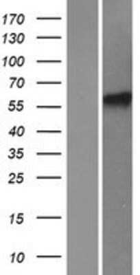 Western Blot: HIRIP3 Overexpression Lysate [NBP2-07975]