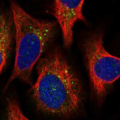 Immunocytochemistry/ Immunofluorescence: HISPPD1 Antibody [NBP2-38368]