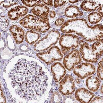 Immunohistochemistry: HISPPD1 Antibody [NBP1-91990]