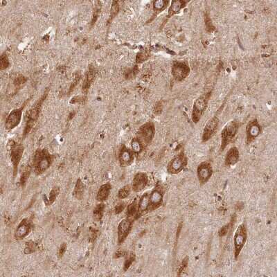 Immunohistochemistry: HISPPD1 Antibody [NBP2-38368]