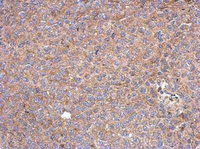 Immunohistochemistry-Paraffin: HISPPD1 Antibody [NBP2-16836]