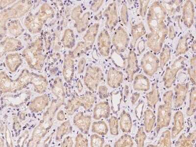 Immunohistochemistry-Paraffin: HISPPD1 Antibody [NBP2-98035]