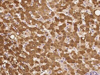 Immunohistochemistry-Paraffin: HISPPD1 Antibody [NBP2-98035]