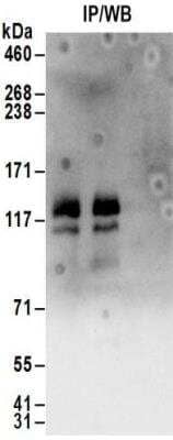 Immunoprecipitation: HISPPD1 Antibody [NBP2-32154]