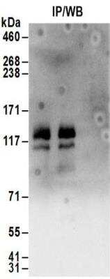 Immunoprecipitation: HISPPD1 Antibody [NBP2-32155]