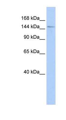 Western Blot: HISPPD1 Antibody [NBP1-54642]