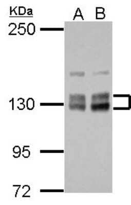 Western Blot: HISPPD1 Antibody [NBP2-16836]