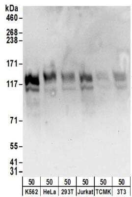 Western Blot: HISPPD1 Antibody [NBP2-32155]