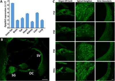 Immunocytochemistry/ Immunofluorescence: HISPPD2A Antibody [NBP1-89693]