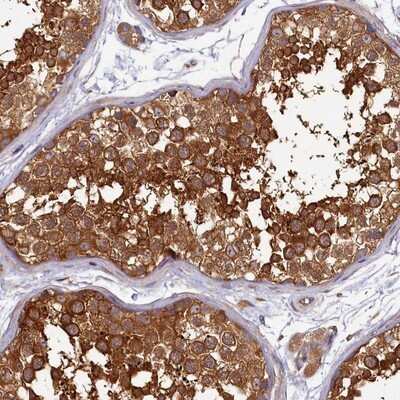 Immunohistochemistry-Paraffin: HISPPD2A Antibody [NBP1-89693]