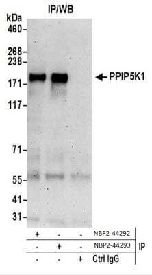 Immunoprecipitation: HISPPD2A Antibody [NBP2-44292]