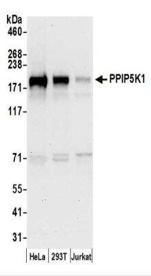 Western Blot: HISPPD2A Antibody [NBP2-44293]