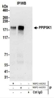 Western Blot: HISPPD2A Antibody [NBP2-44293]