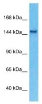 Western Blot: HISPPD2A Antibody [NBP3-09416]