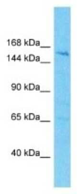 Western Blot: HISPPD2A Antibody [NBP3-09937]