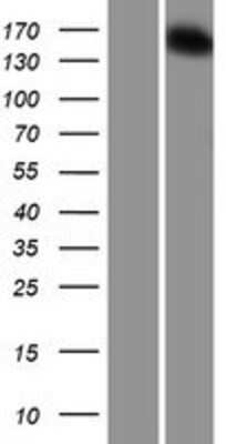 Western Blot: HISPPD2A Overexpression Lysate [NBP2-10309]