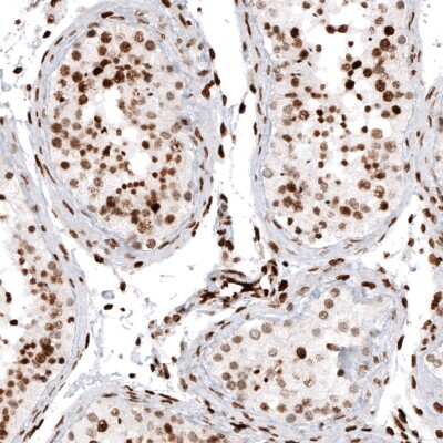 Immunohistochemistry-Paraffin: HIST1H2AG Antibody (CL5039) [NBP2-61151]