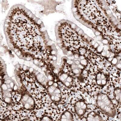 Immunohistochemistry-Paraffin: HIST1H2AG Antibody (CL5039) [NBP2-61151]