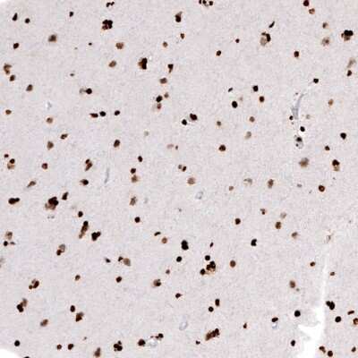 Immunohistochemistry: HIST1H2AG Antibody (CL5039) [NBP2-61151]