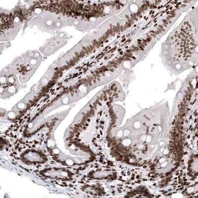 Immunohistochemistry: HIST1H2AG Antibody (CL5041) [NBP2-61152]