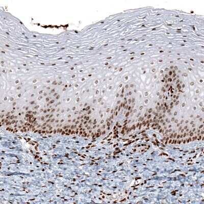 Immunohistochemistry: HIST1H2AG Antibody (CL5041) [NBP2-61152]