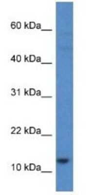 Western Blot: HIST1H2AH Antibody [NBP1-79874]