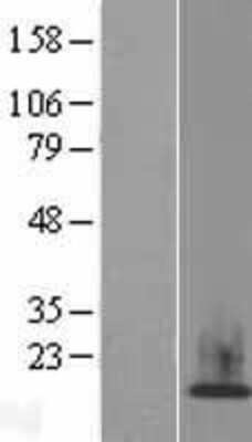 Western Blot: HIST1H2AH Overexpression Lysate [NBP2-05777]